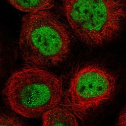 SLC22A16 Antibody, Novus Biologicals:Antibodies:Primary Antibodies